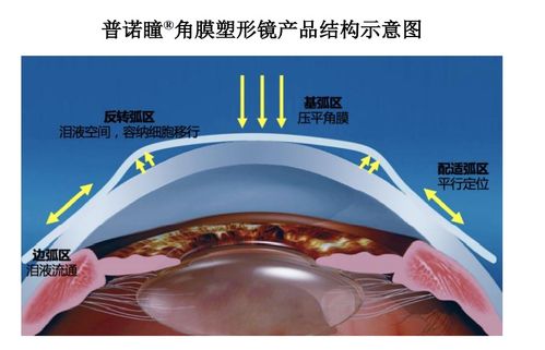 眼科新銳愛博醫(yī)療 技術(shù)先鋒的全球化征程